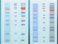 Gel Electrophoresis 9